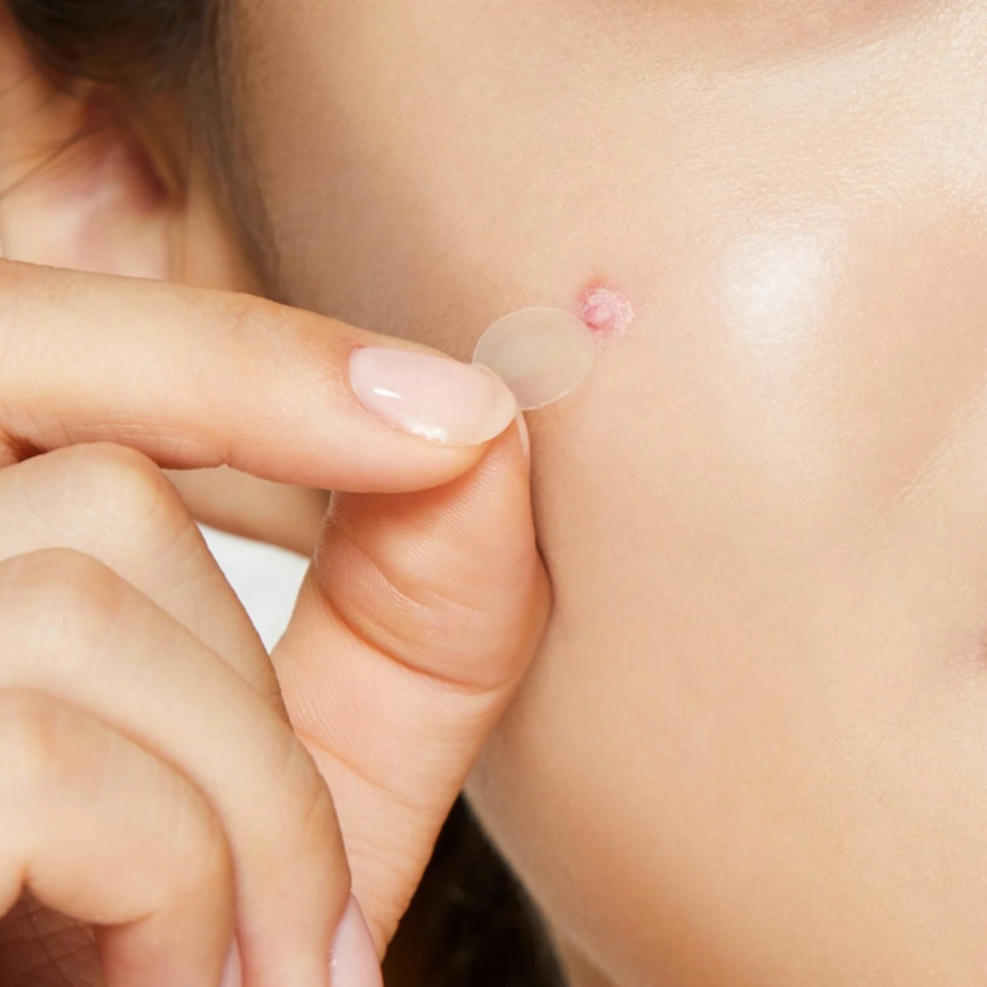 Clear Fit Master Patch | Parches para granitos ultra delgados